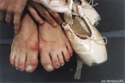 Ballet Pointe Shoes Warming Up and Toe Nail Problem